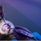 Different types of Dental filling