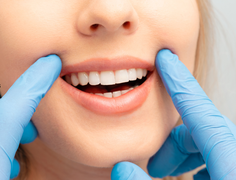 How to Care for Your Teeth After a Dental Procedure