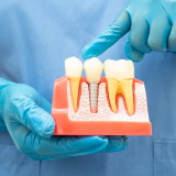 Top 5 Signs You Need a Root Canal – Don’t Ignore These Dental Red Flags