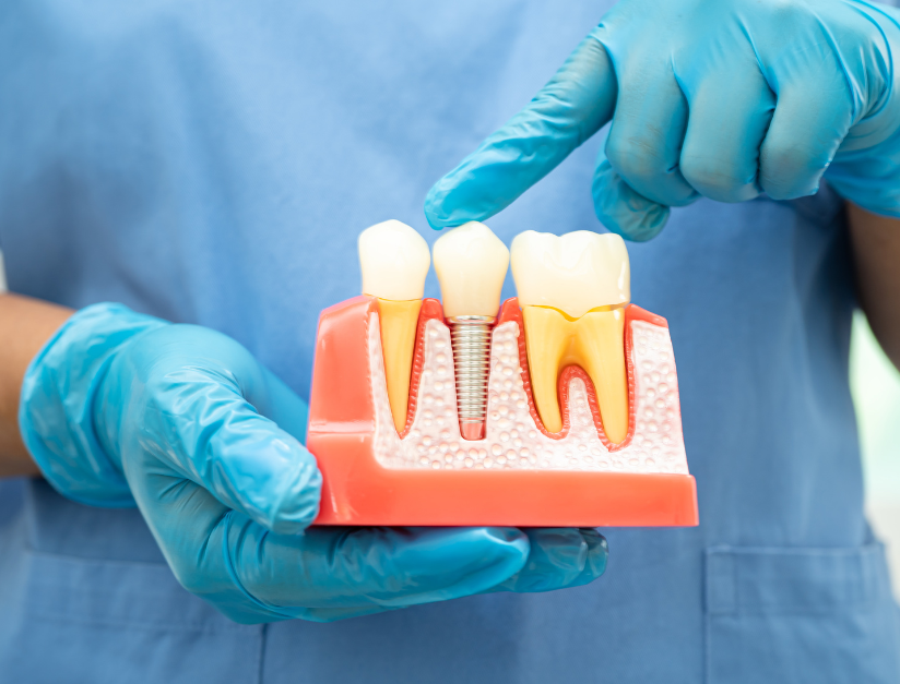 Top 5 Signs You Need a Root Canal – Don’t Ignore These Dental Red Flags