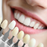 Teeth Whitening in Kanpur