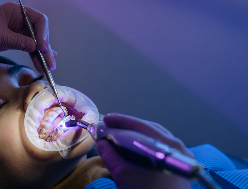Is Your Old Dental Cap Failing? Warning Signs