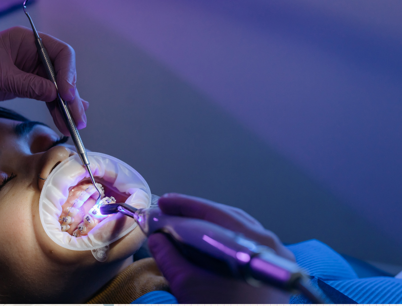 Different types of Dental filling