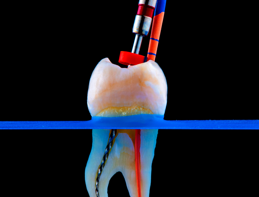 Are Tooth Caps Just Cosmetic