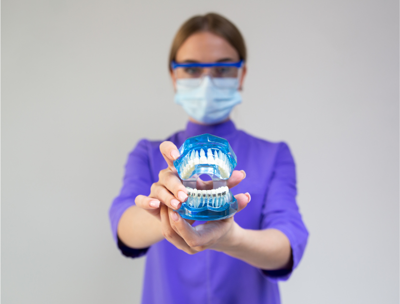 Dental Braces Cost in India in 2025