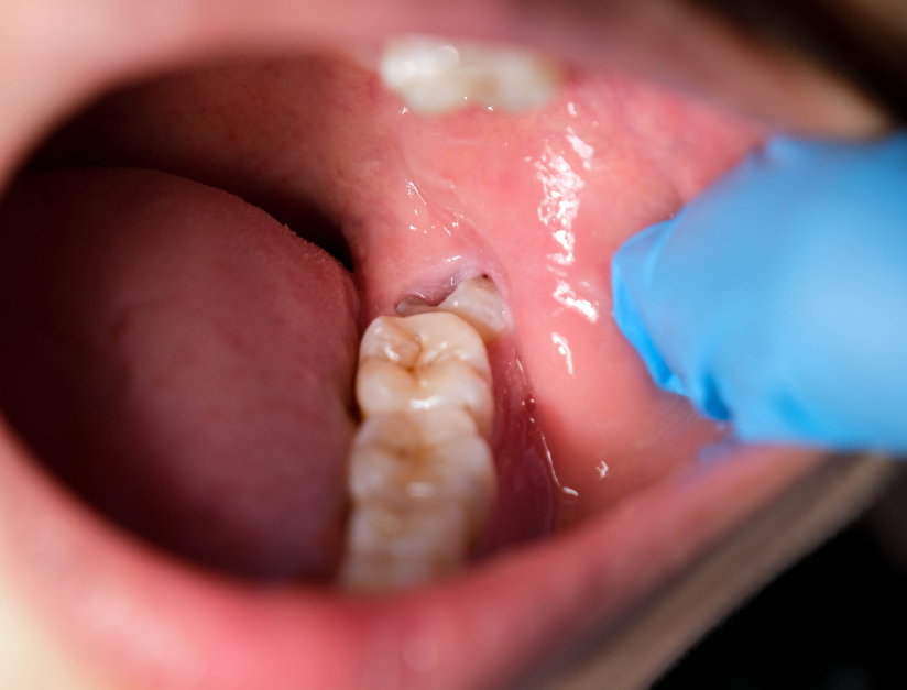 How Pregnancy Affects Your Teeth and Gums: What Mothers Should Know