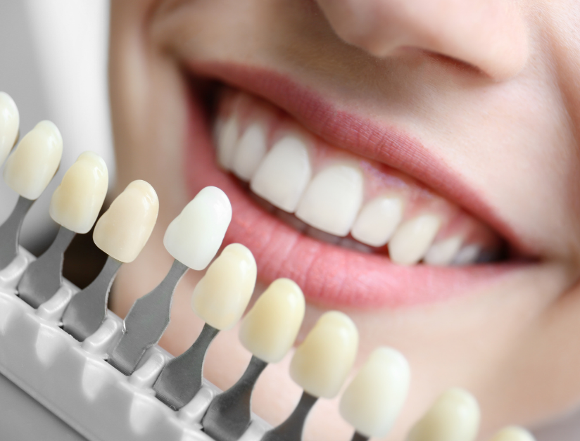 Teeth Whitening Safety: Best Methods, Risks & Natural Options